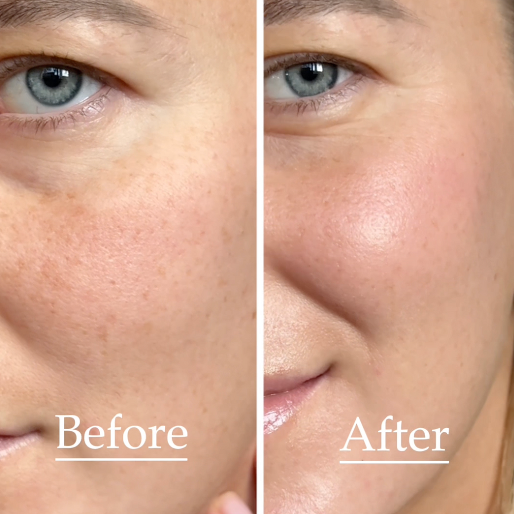 
                      
                        Dawn Break Moi-starter™ | One Step 3-in-1 Solution
                      
                    