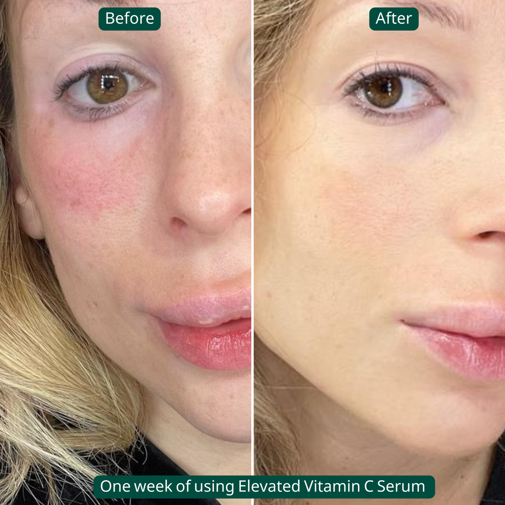 
                      
                        Evoke Elevated Vitamin C Serum - Tightens Skin & Brightens Skin
                      
                    