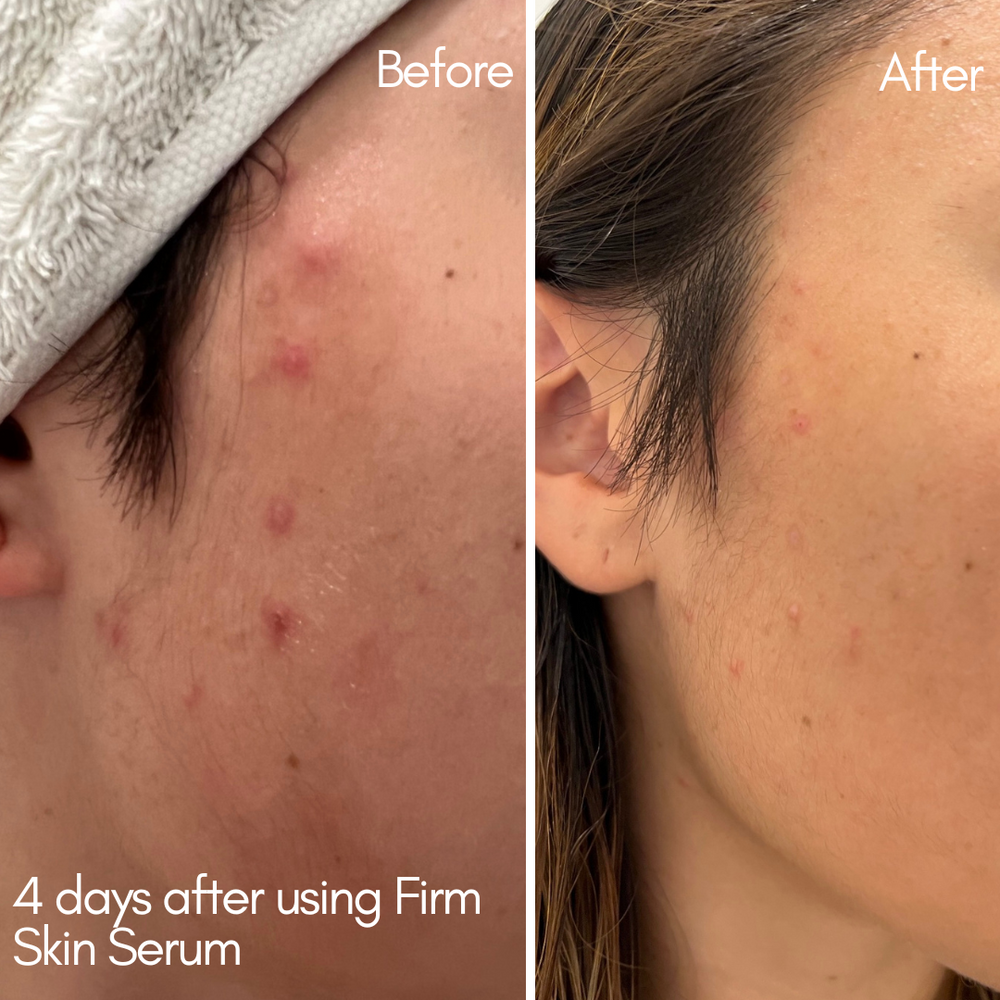 
                      
                        Evoke Firm Skin Serum
                      
                    